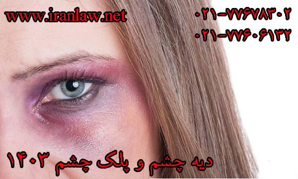 دیه چشم و پلک چشم 1403