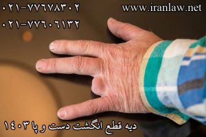 دیه قطع انگشت دست و پا 1403